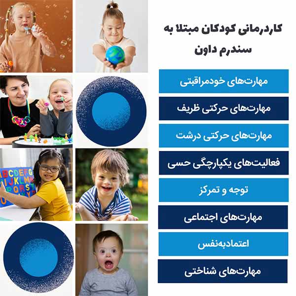 کاردرمانی کودکان مبتلا به سندرم داون