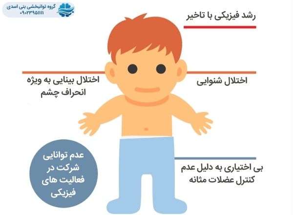 علائم فلج مغزی در نوزادان