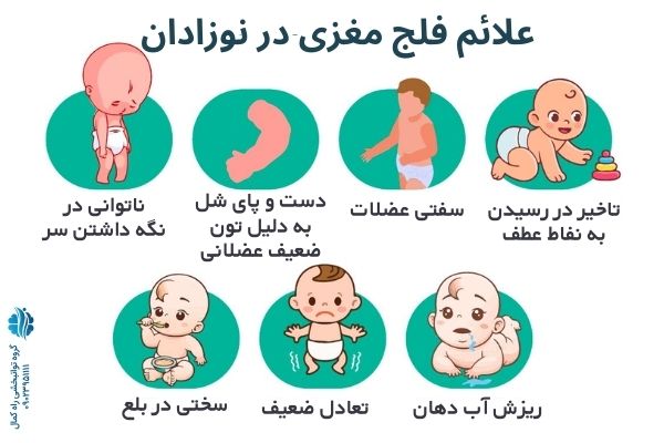 علائم فلج مغزی در نوزادان