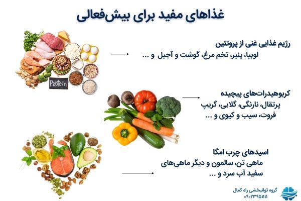 غذاهای مفید برای بیش فعالی