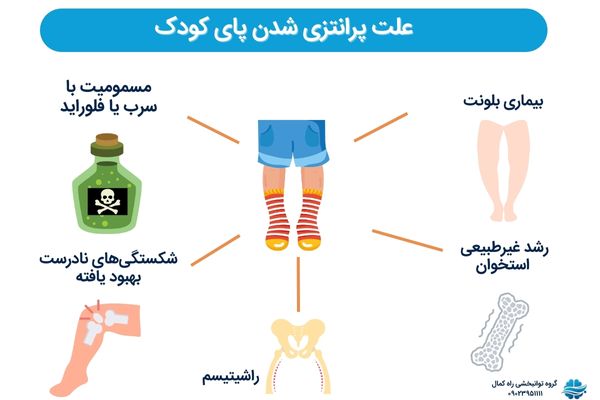 علت پاپرانتزی شدن کودکان