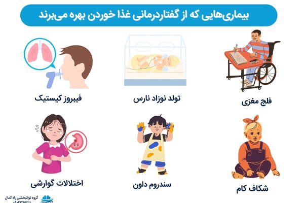 بیماری هایی که گفتاردرمانی به مشکل غذا خوردن آنها کمک می کند