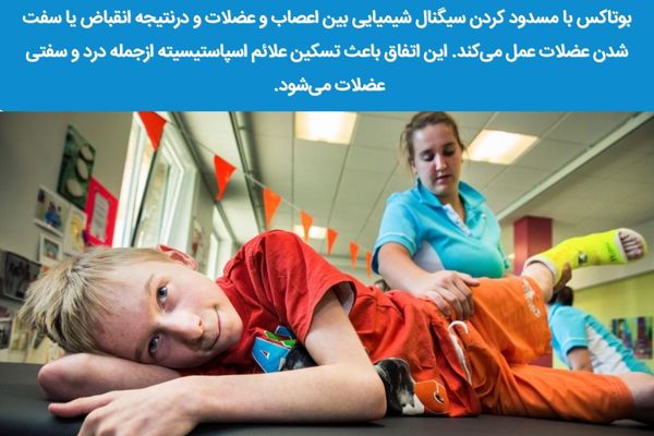 نحوه عملکرد بوتاکس