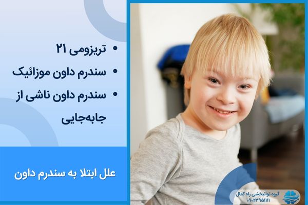دلایلی که باعث سندروم داون می شوند