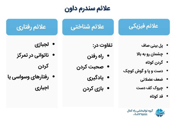 علائم سندروم داون