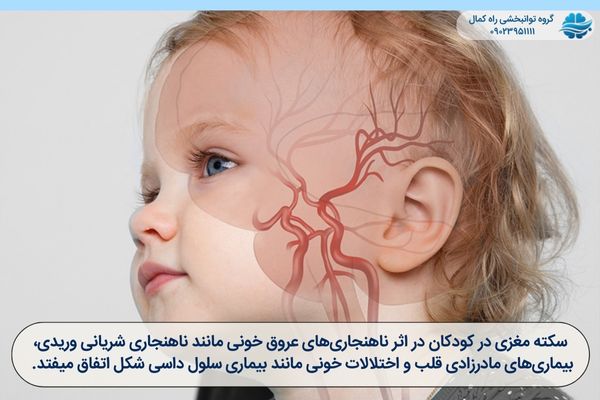 علت سکته مغزی