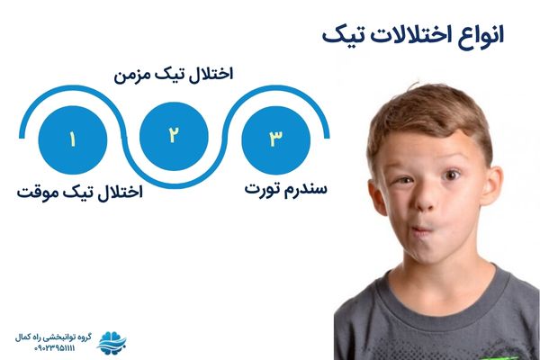 انواع تیک