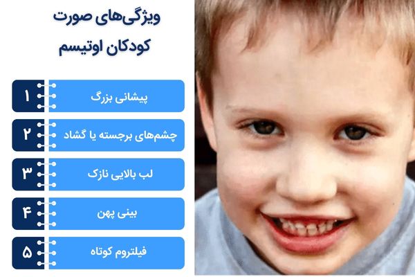 ویژگی های چهره