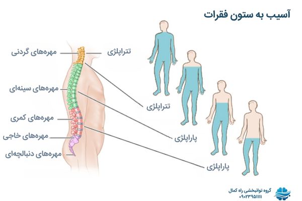 انواع آسیب به ستون فقرات