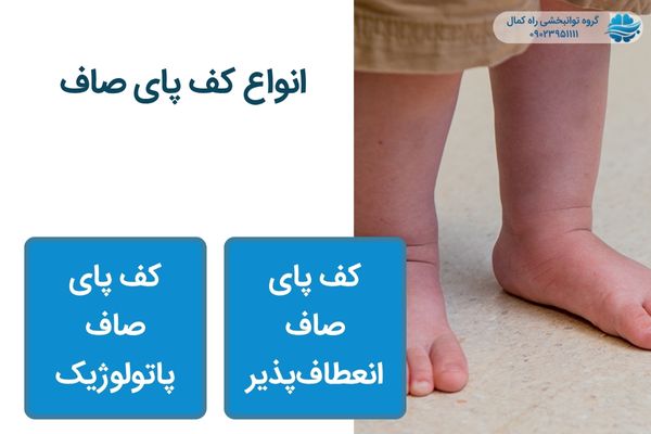انواع کف پای صاف