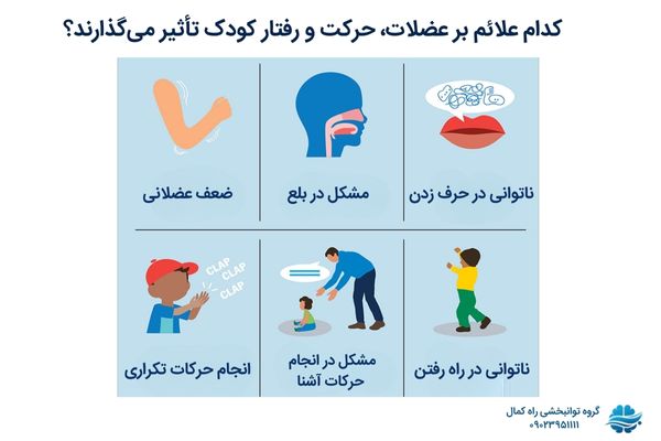 علائم سندرم رت