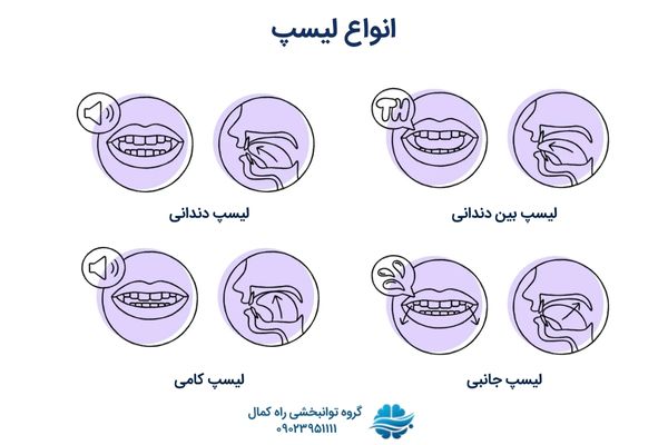 انواع لیسپ