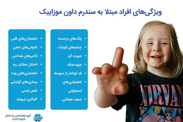 علائم سندرم داون