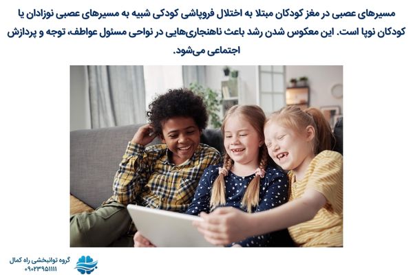 ارتباط ساختار مغز با اختلال فروپاشی کودکی