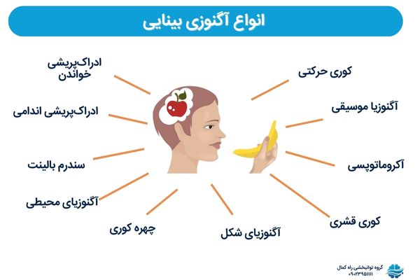 انواع آگنوزیای بینایی