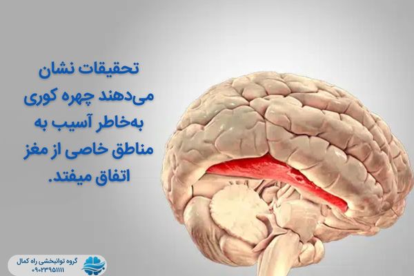 آسیب مغز علت پروسوپاگنوزیا