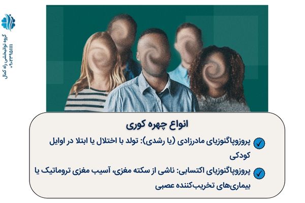 انواع مختلف چهره کوری