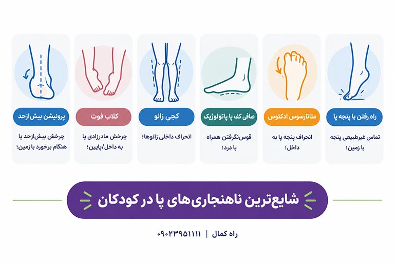شایع ترین دفورمیتیهای پا در کودکان