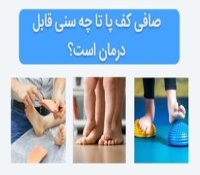 کف پای صاف تا چه سنی قابل درمان است؟ آیا زمان مناسبی دارد؟