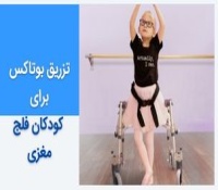 تزریق بوتاکس برای کودکان فلج مغزی: مزایا و خطرات این نوع درمان