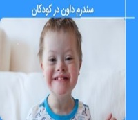 سندرم داون در کودکان: چطور با این اختلال کنار بیاییم؟