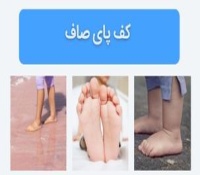 صافی کف پا در کودکان - علت، علائم، نحوه تشخیص و درمان