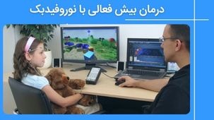 درمان بیش فعالی با نوروفیدبک و میزان اثربخشی آن